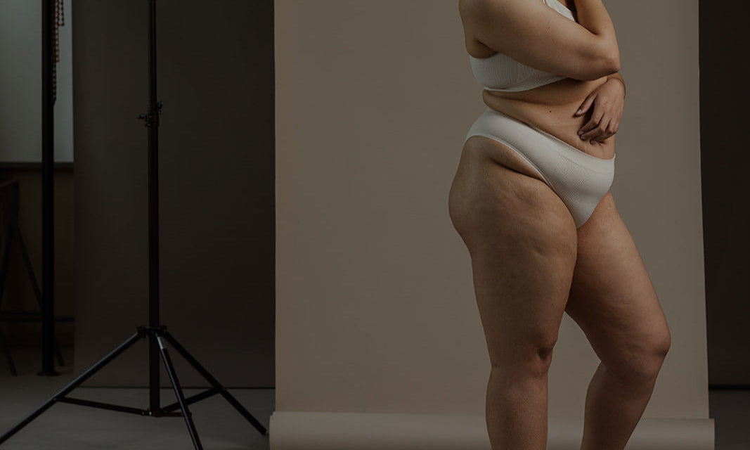Keratosis Pilaris