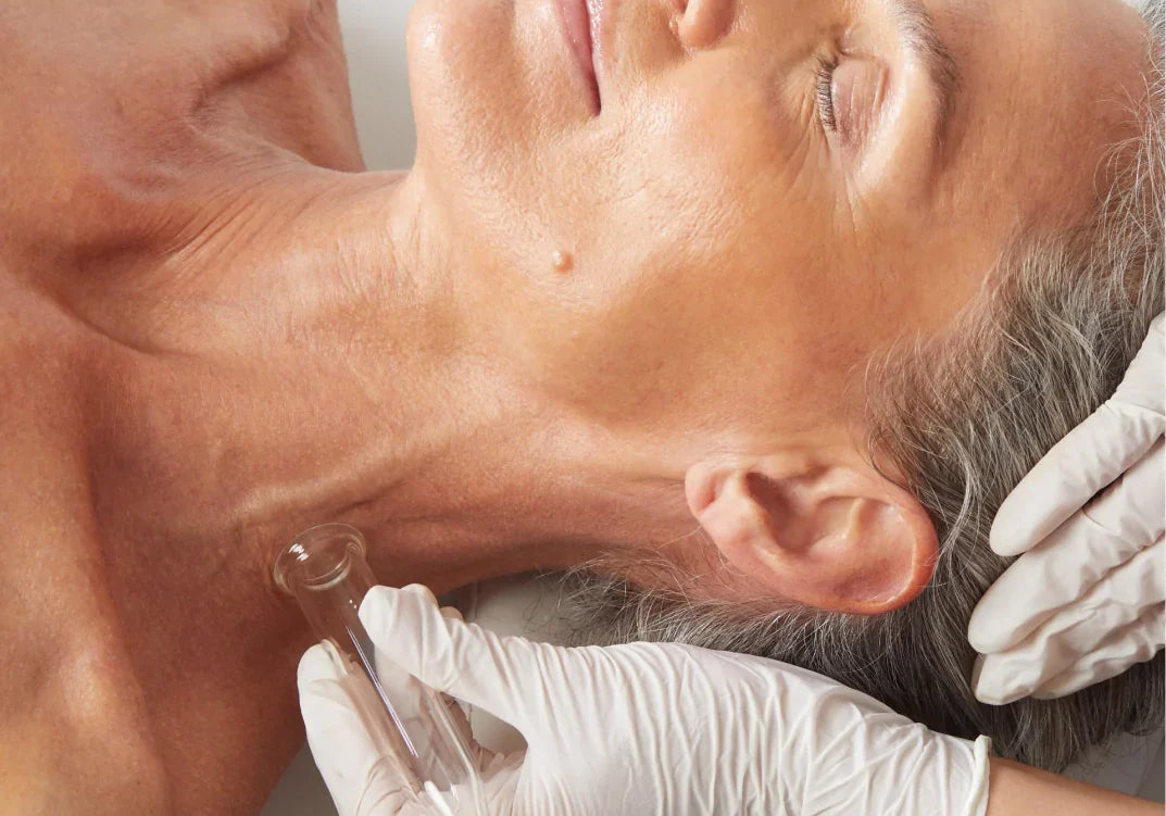 Hydrafacial – Before and Aftercare