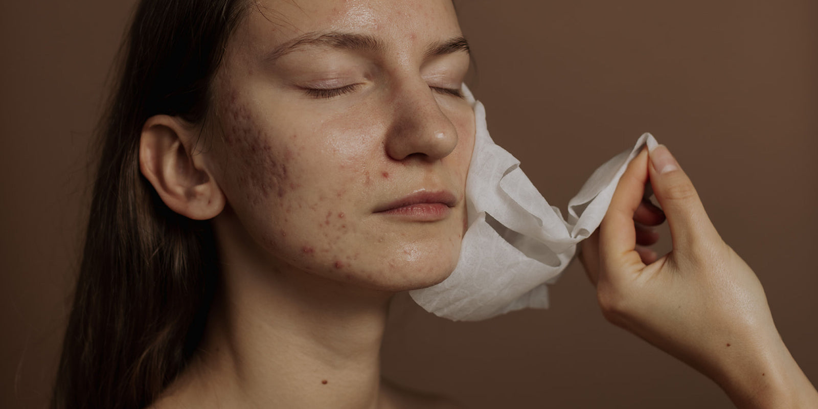 Person applying a white patch to their face against a brown background