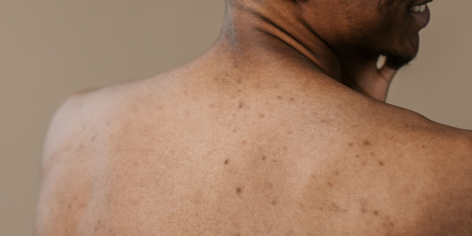Close-up of a person's back with a neutral background