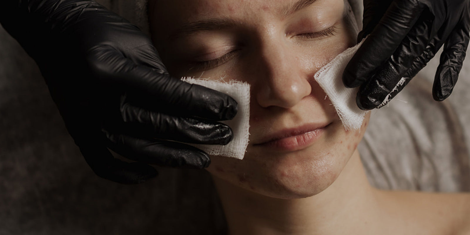 Person receiving a facial treatment with black gloves and white cloths on a neutral background