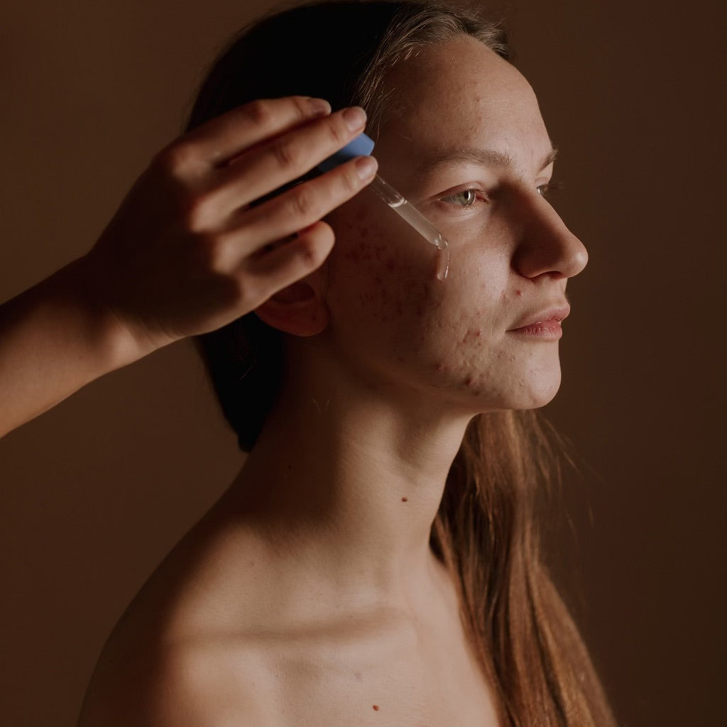 Bare Solutions Acne Örebro