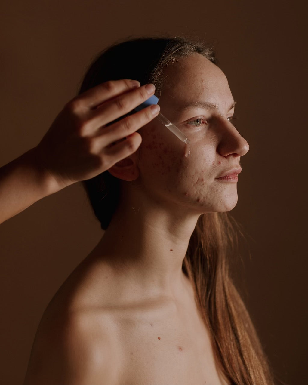 Bare Solutions Acne Örebro