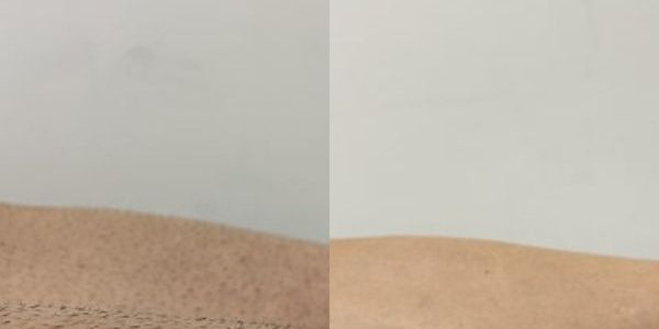 Two skin texture samples side by side on a neutral background