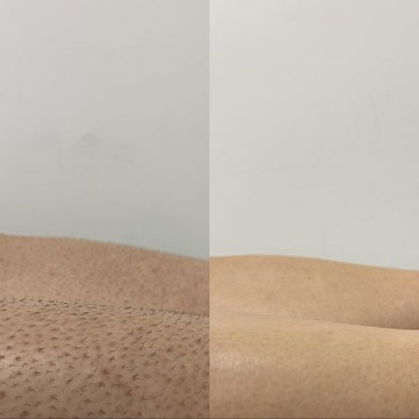 Two skin texture samples side by side on a neutral background
