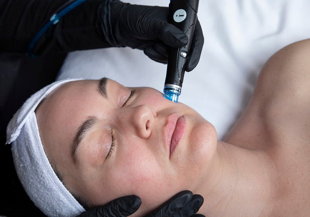 hydrafacial treatment örebro
